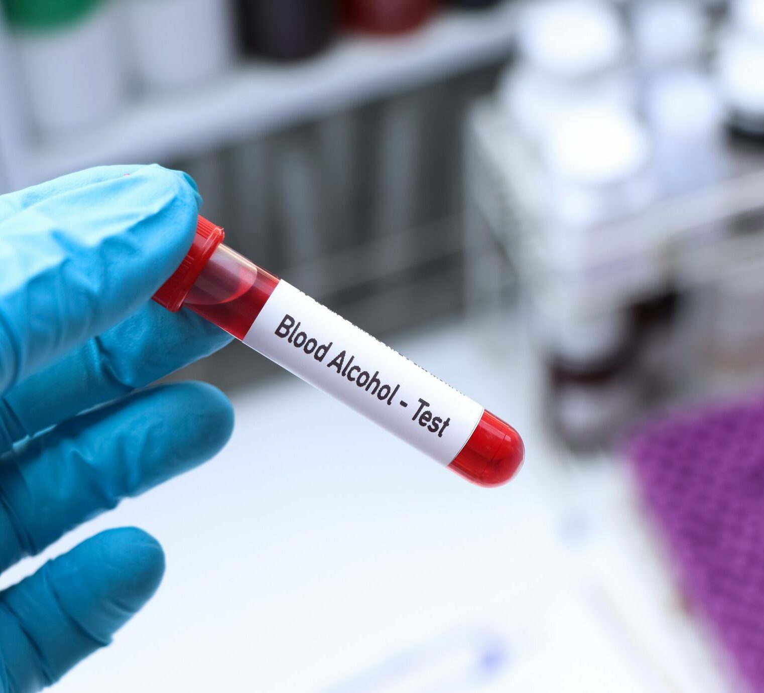 Blood Alcohol tes